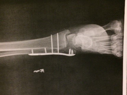 Putting all the pieces together again!