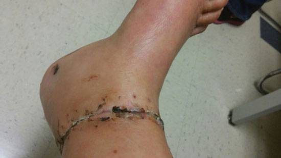 The Bionic Woman and the power of helping cells help themselves!